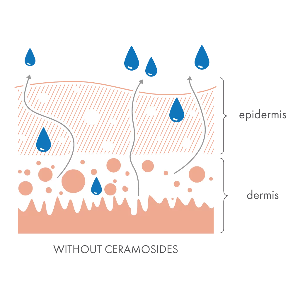Without Ceramosides