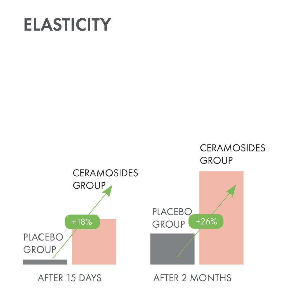 Elasticity