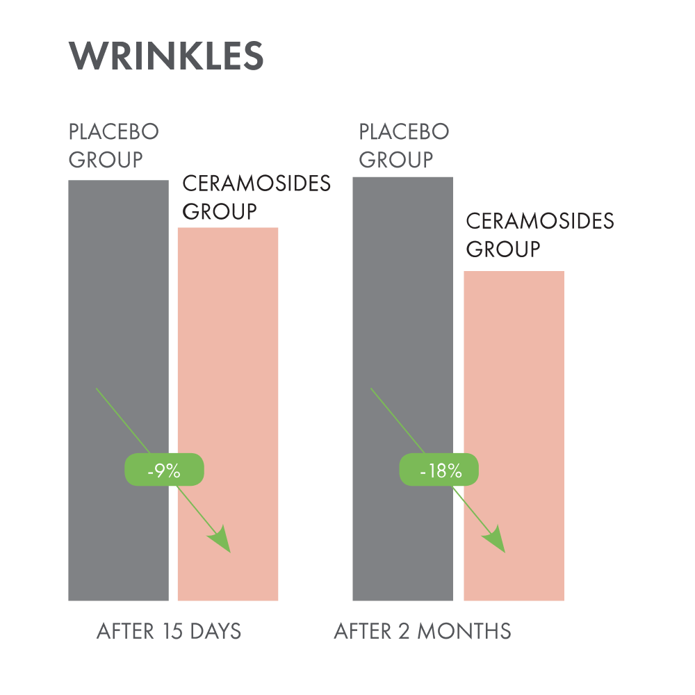 Wrinkles